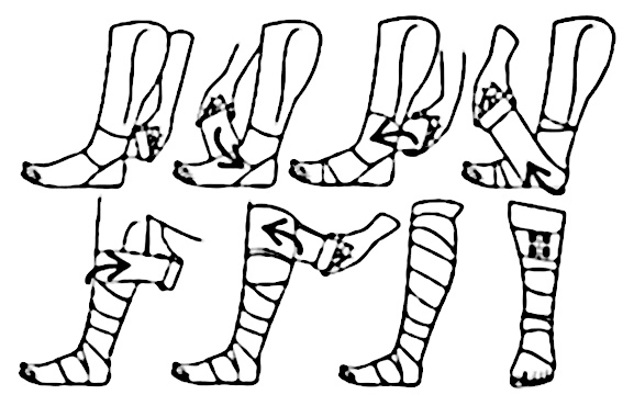 Как правильно бинтовать ногу эластичным бинтом при варикозе? | Статьи  Детралекс